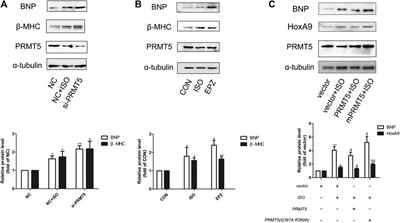 PRMT5 Prevents Cardiomyocyte Hypertrophy via Symmetric Dimethylating HoxA9 and Repressing HoxA9 Expression